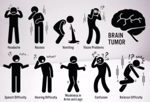 Brain Tumor